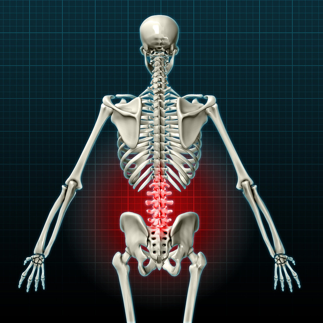 Lower Back Pain,Illustration