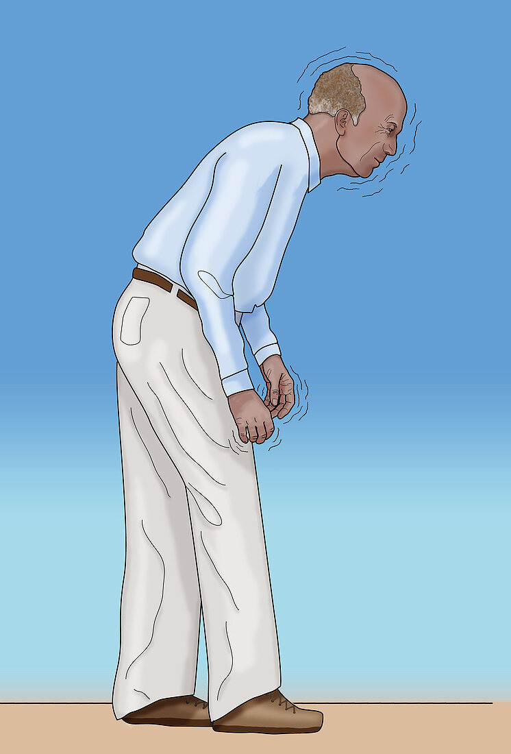 Man with Parkinson's,Illustration