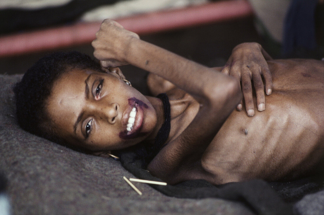 Ethiopian Girl,Near Death