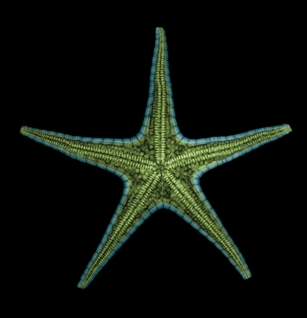 X-ray of Starfish