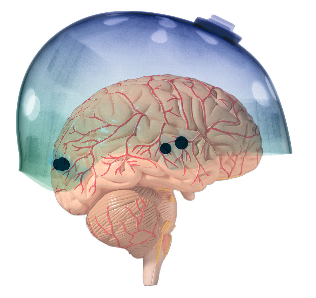 Brain in Skateboard Helmet