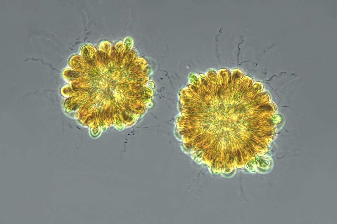 Synura Uvella Colonies,LM