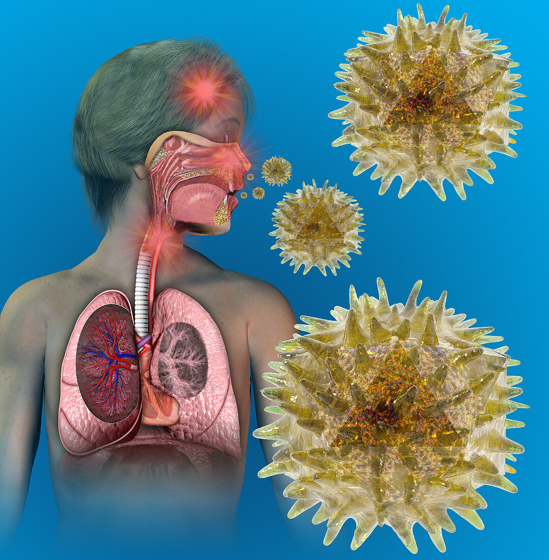 Rhinovirus and common cold,illustration