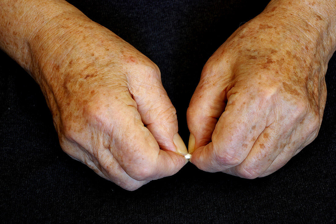Elderly hands break a pill