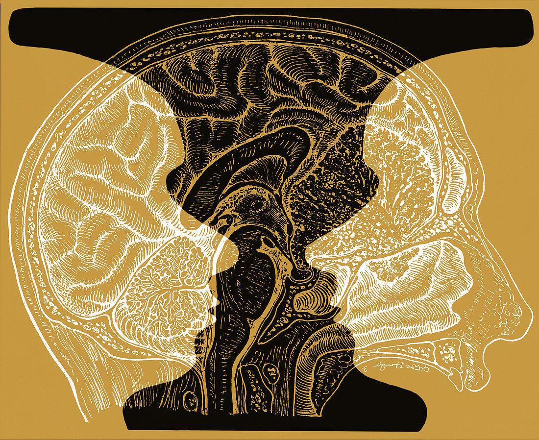 Rubin Vase and Brain,illustration