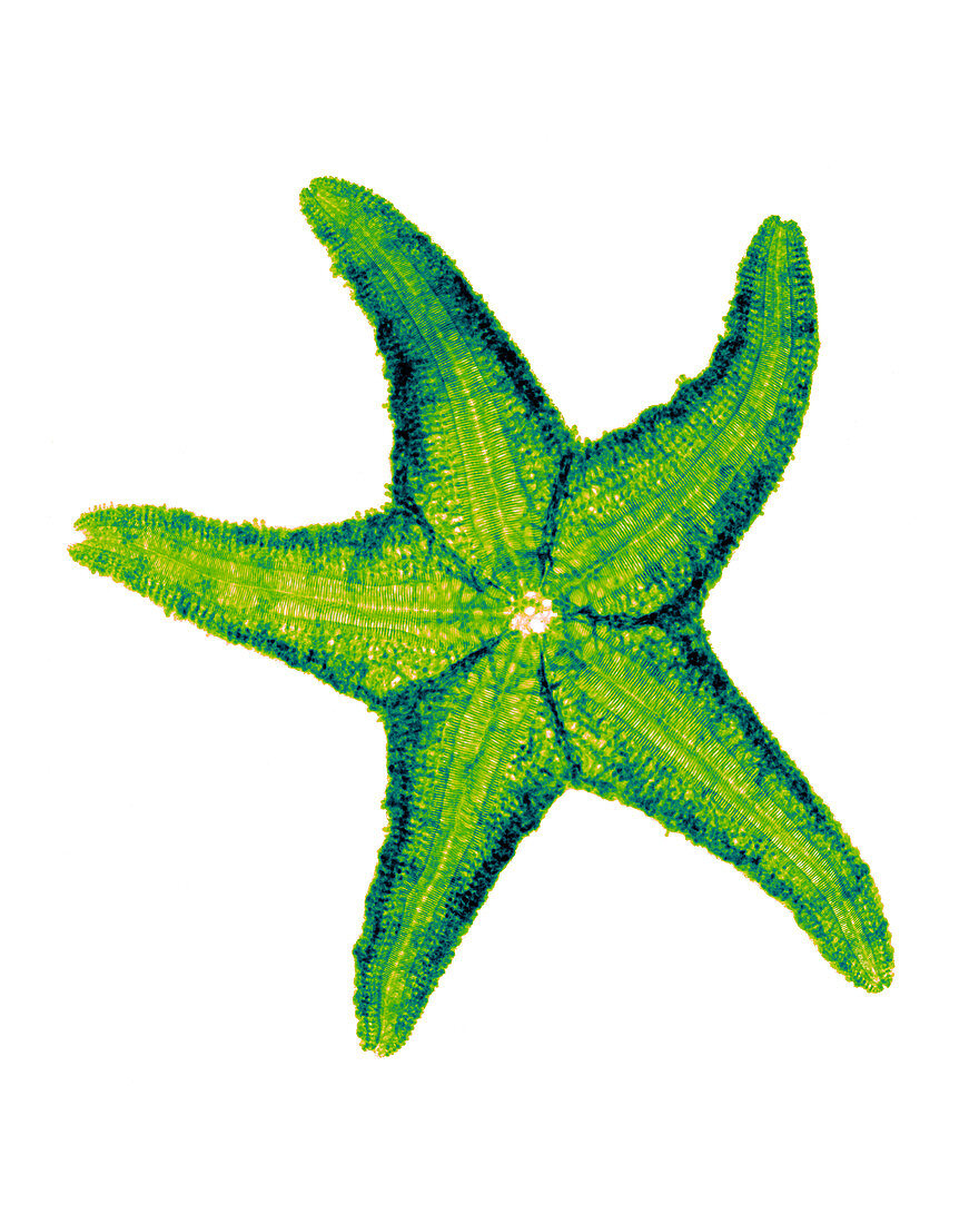 X-ray of Starfish