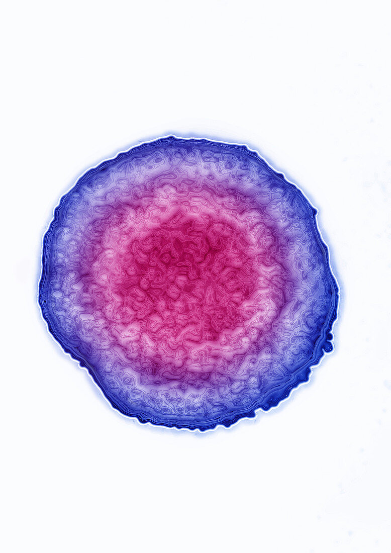 Hepatitis D virus (HDV)