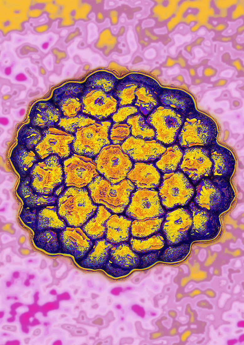 Papillomavirus (HPV)