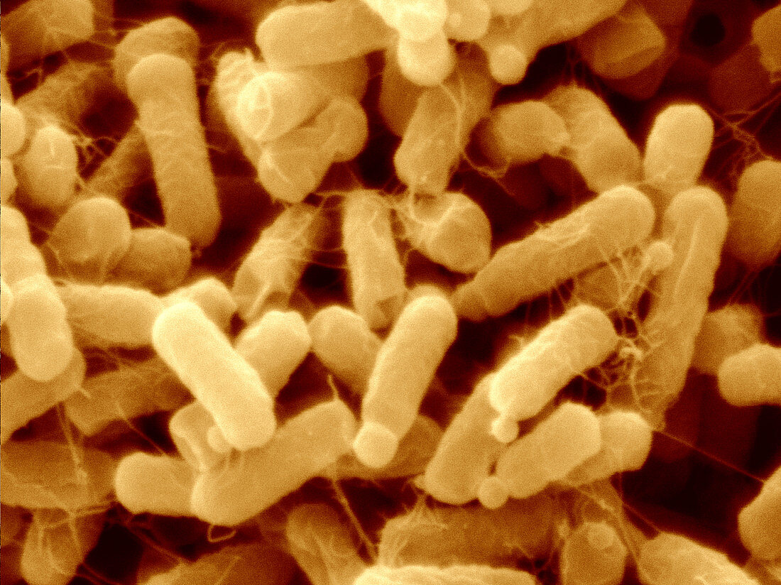 Toxigenic Escherichia coli O45
