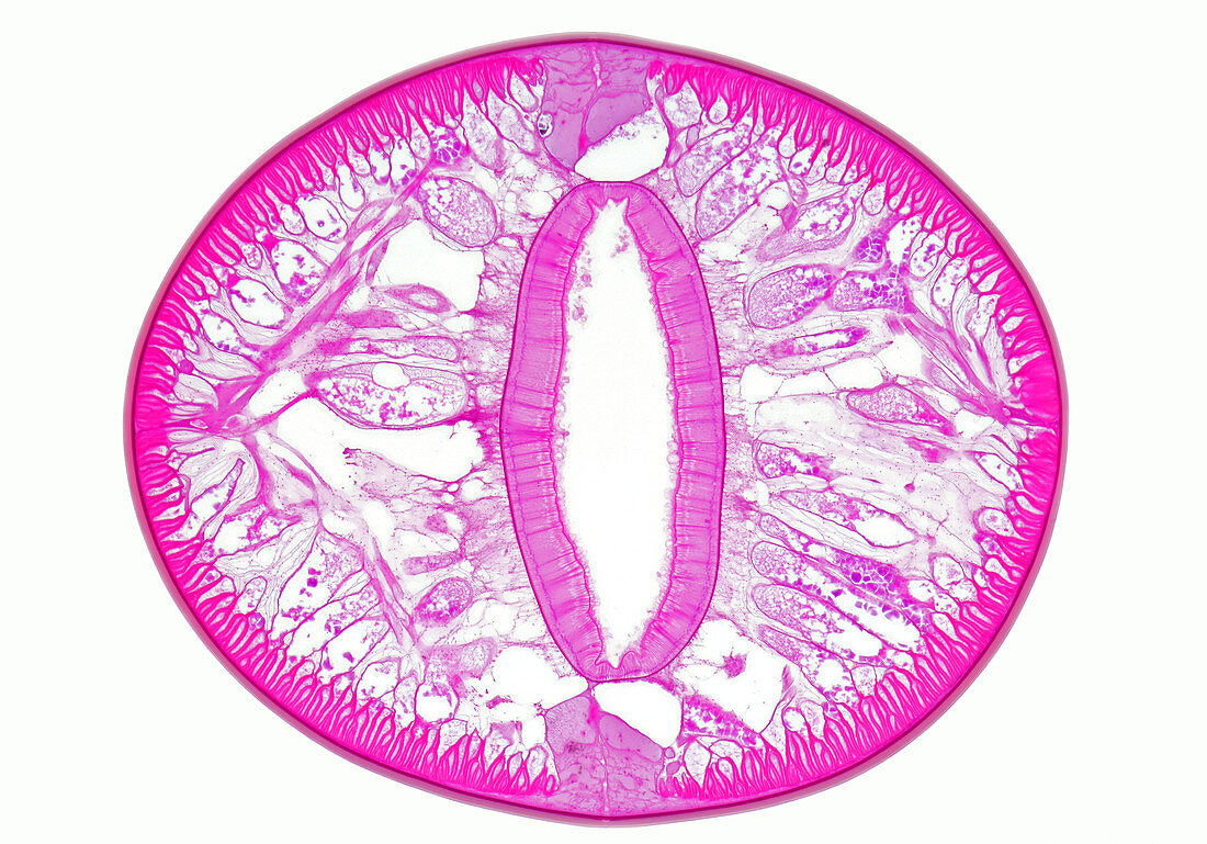 Roundworm (Ascaris)