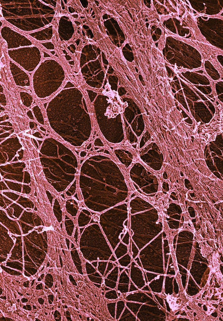 3T3 Fibroblast Cytoskeleton,TEM