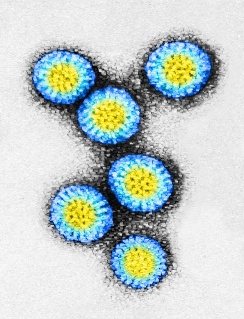 TEM of Rotavirus