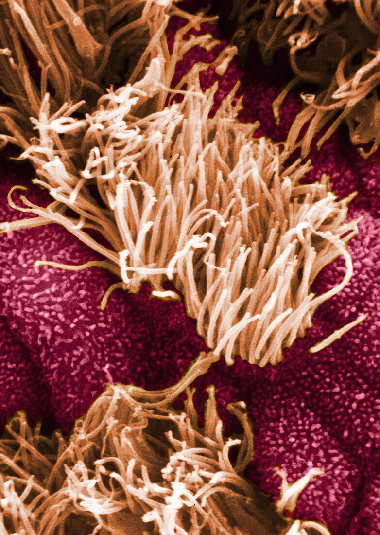 SEM of Human Oviductal Epithelium