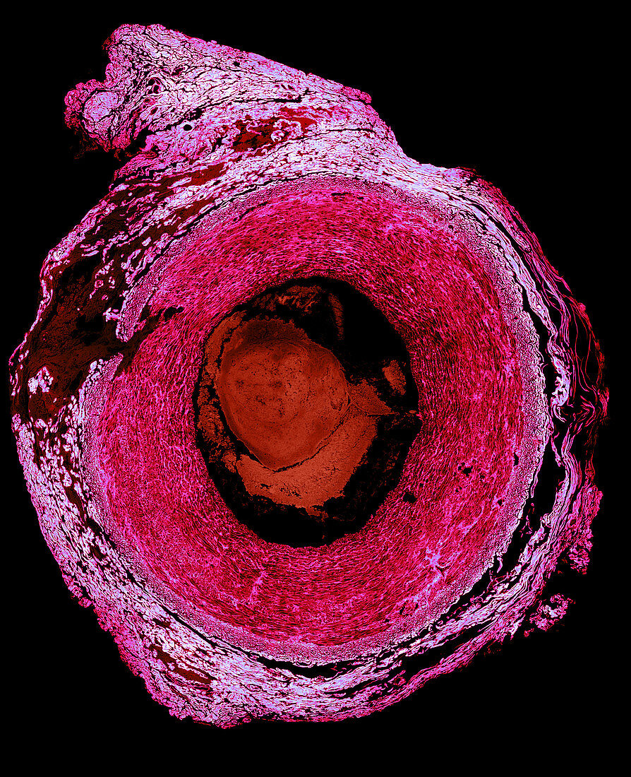 Light Micrograph of Carotid Artery