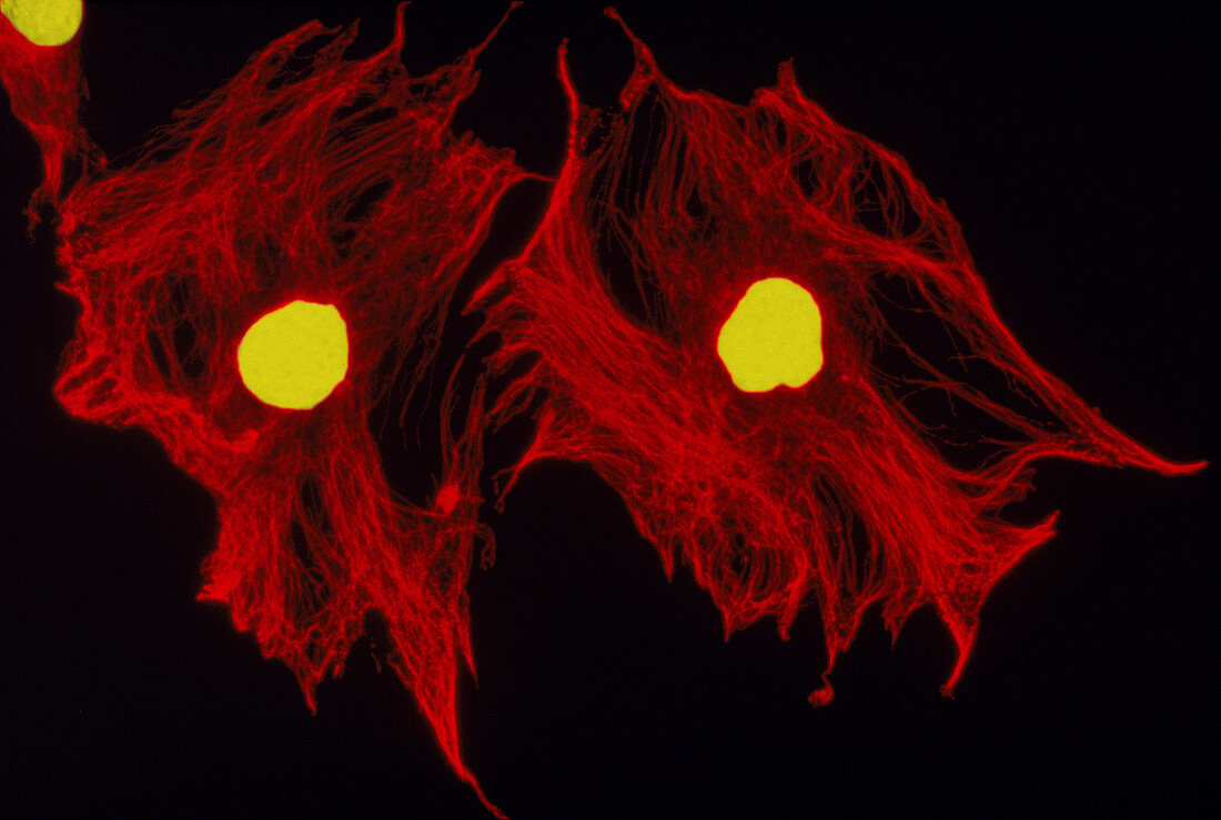 Fibroblasts,LM