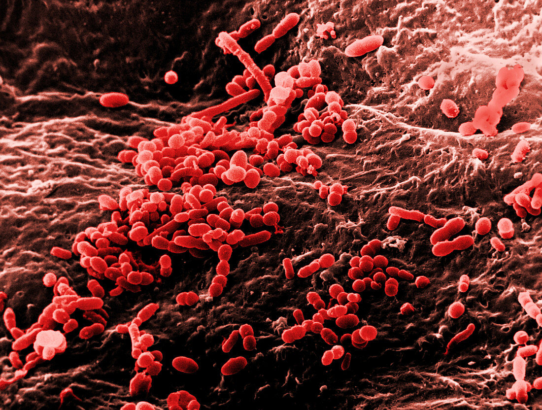 Skin Bacteria,SEM