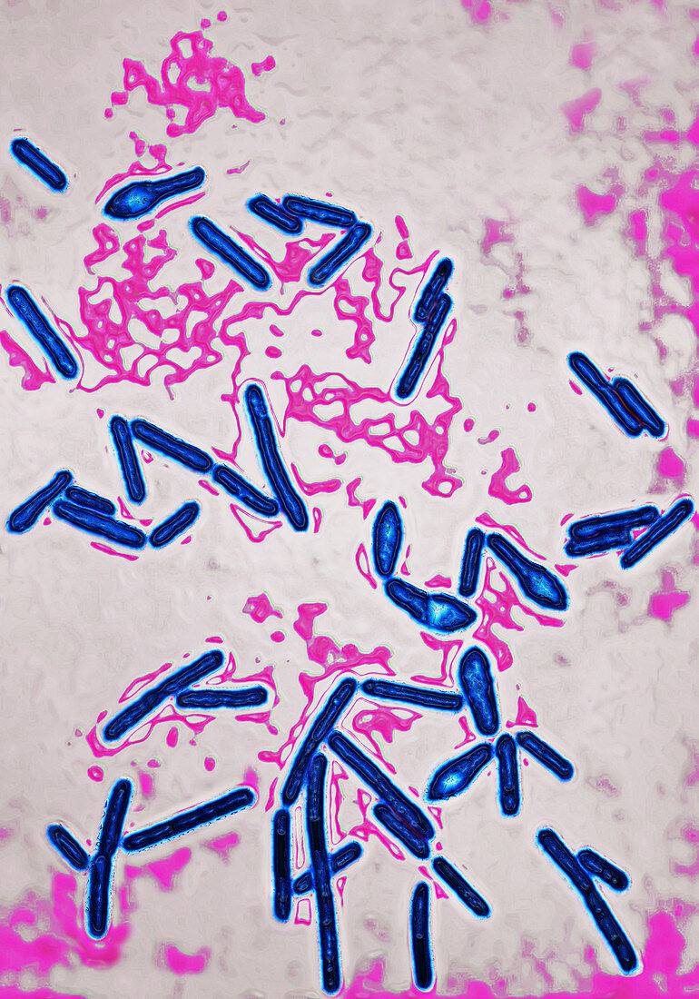 Botulism bacillus