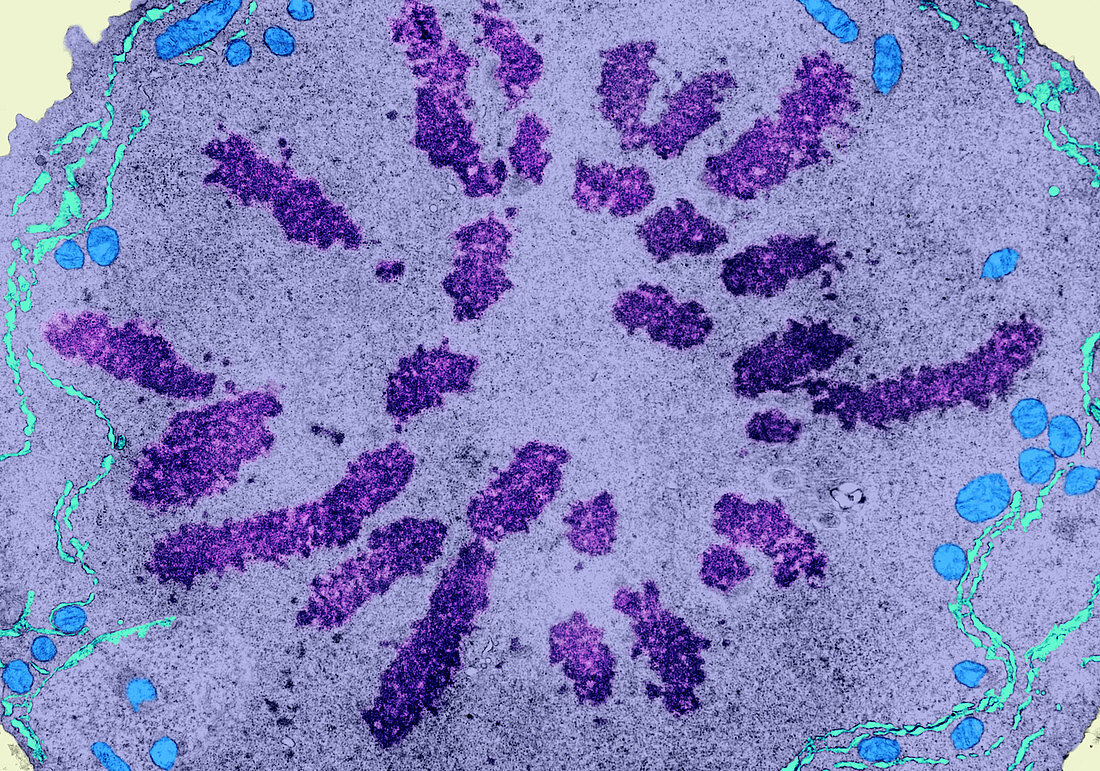 Metaphase (TEM)