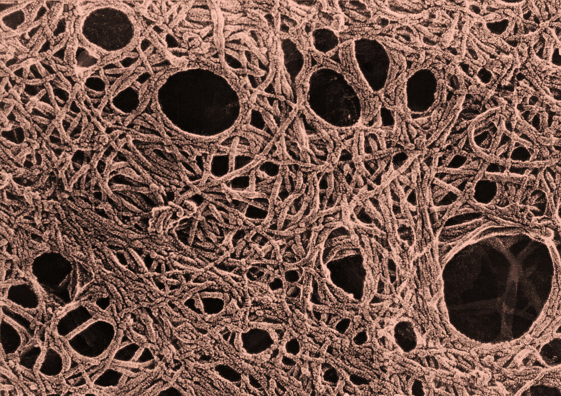 Cytoskeleton of Tissue Culture Cells,TEM