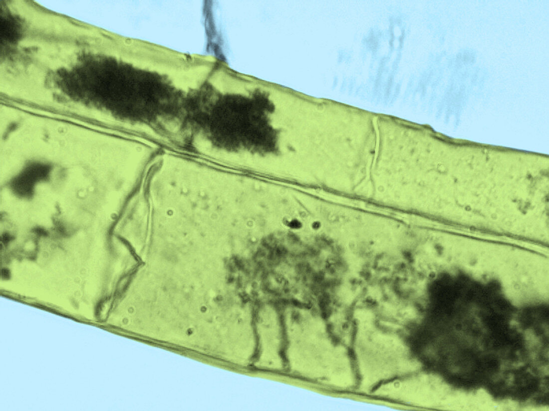 Arbuscules,Corn Root Cells