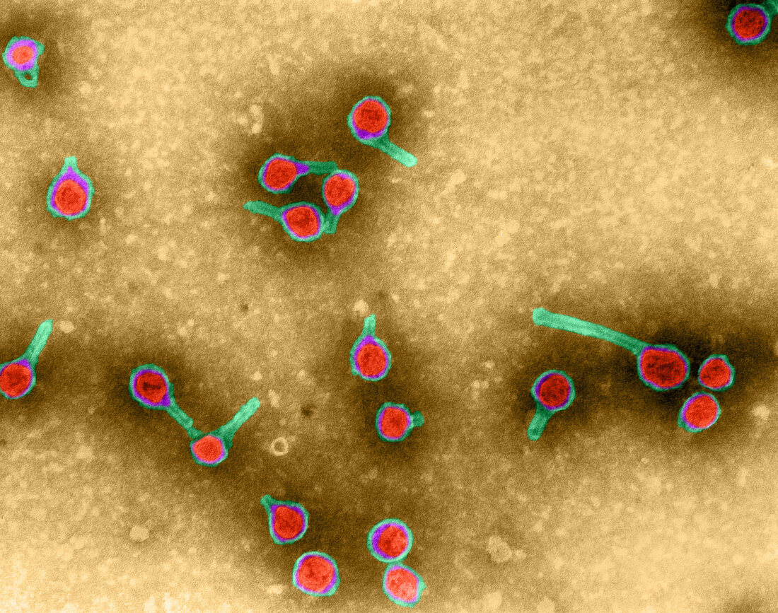 Rauscher Leukemia Virus,TEM