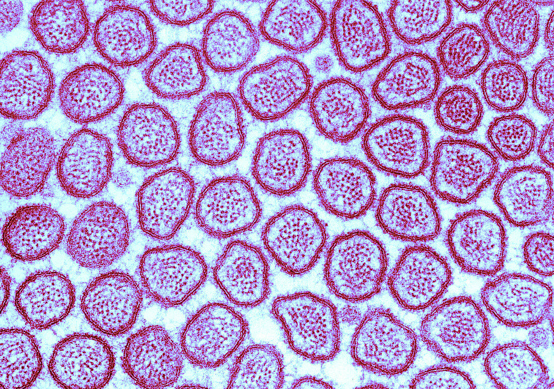 Microvilli in Intestinal Epithelium,TEM