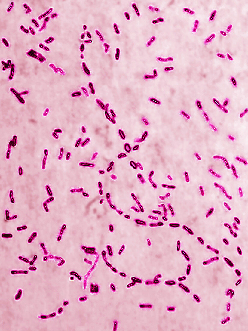 Haemophilus pertussis bacteria,LM