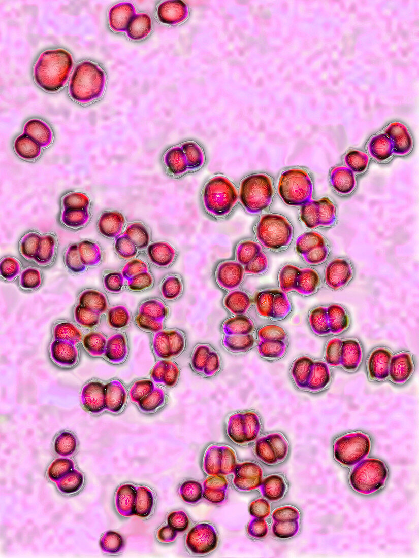 Neisseria meningitidis bacteria,LM