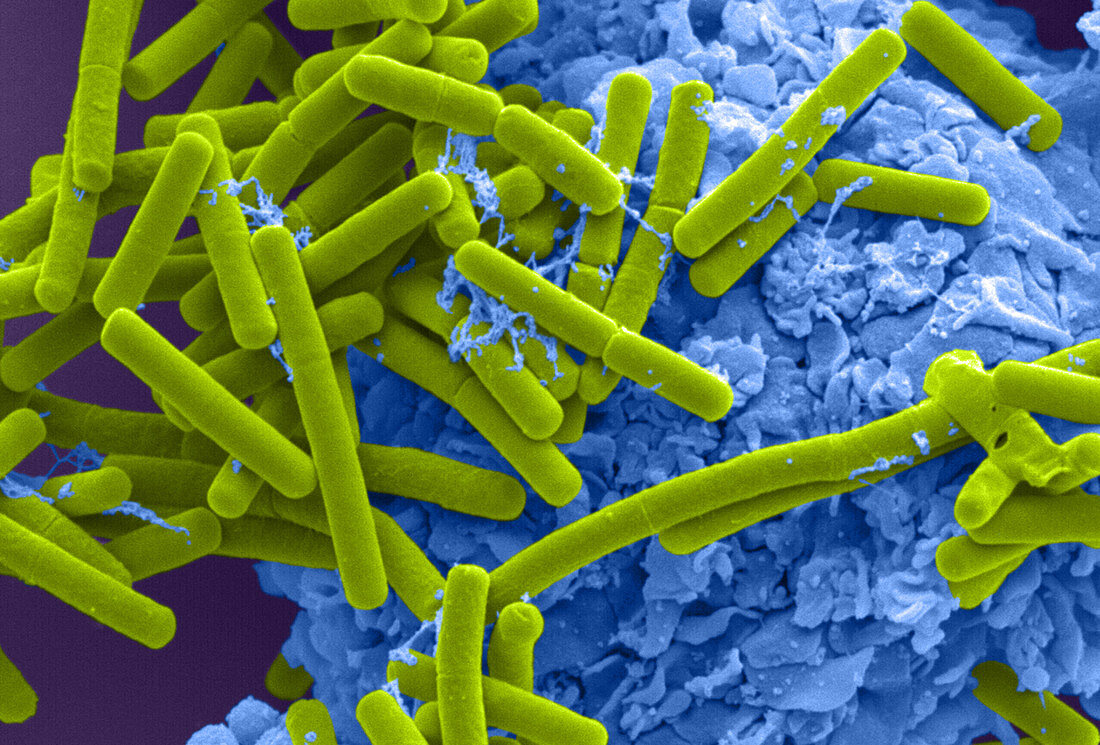 E. coli and Macrophage (SEM)