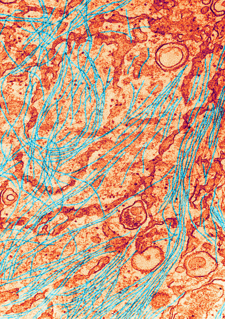 TEM of Cytoplasm of 3T3 Cell