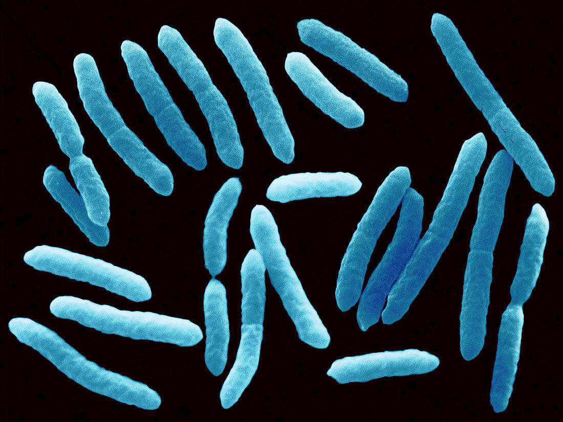 Toxigenic Escherichia coli O145,SEM