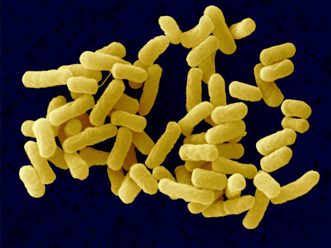 Escherichia coli O26