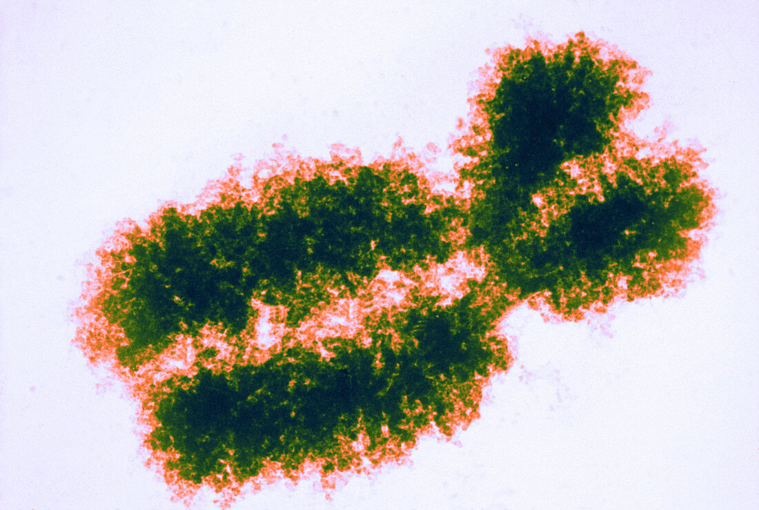 Metaphase Chromosome