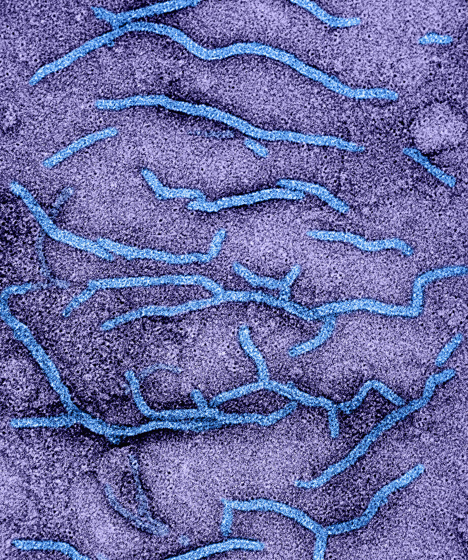 Mycobacterium tuberculosis,TEM