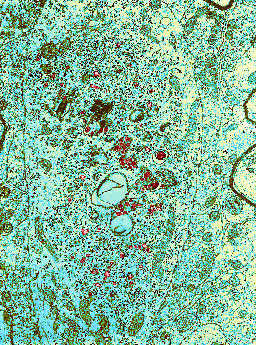 Group C RNA tumour virus particles,TEM