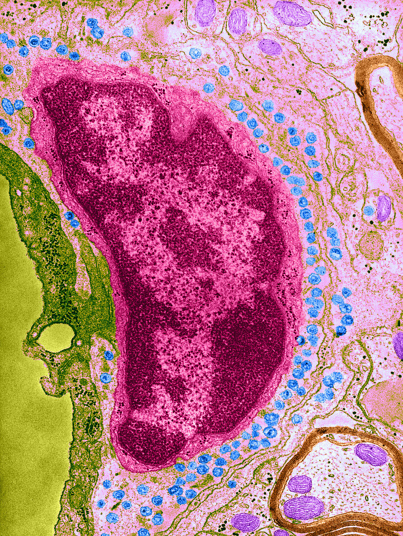 Group C RNA tumour virus particles,TEM