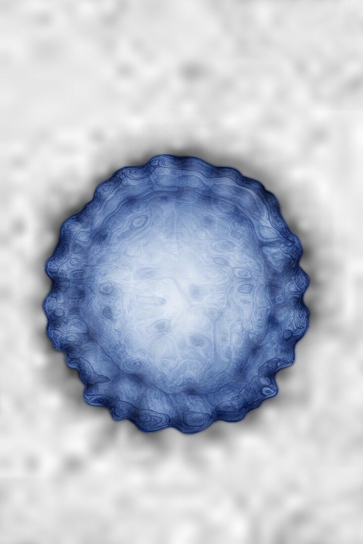 Hepatitis B Virus (HBV)