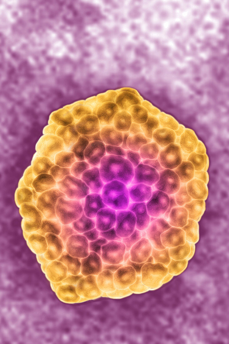 Hepatitis E Virus (HEV)