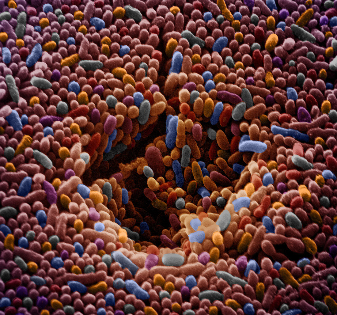 SEM of Polluted Water