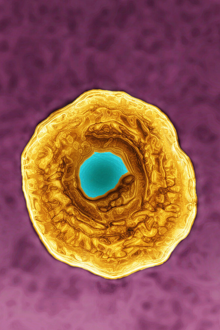 Herpes Simplex Virus,TEM