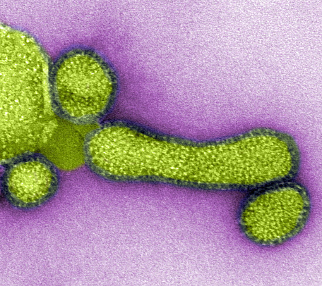 H1N1,Influenza A Virus,Swine Flu,TEM