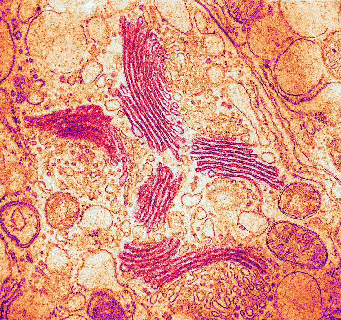 TEM of Golgi Bodies