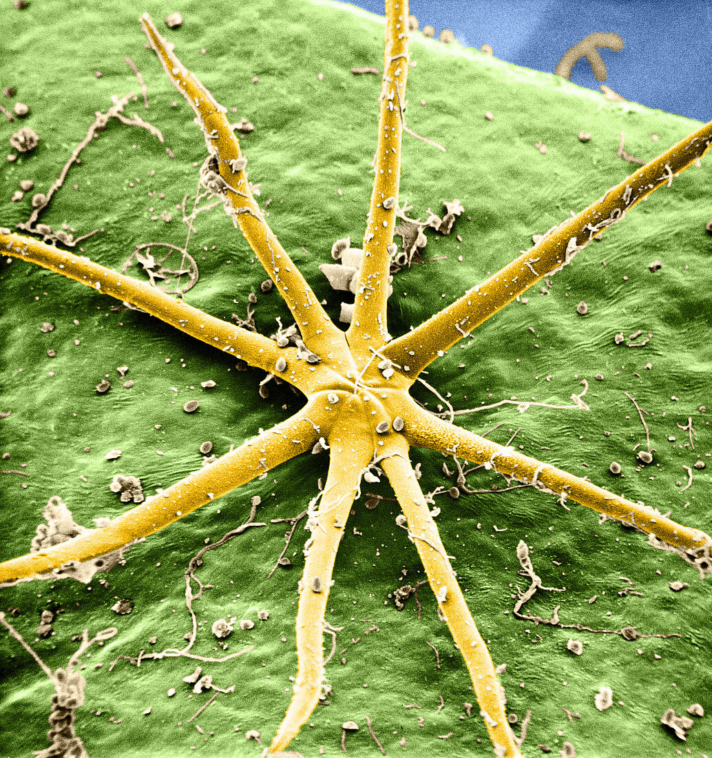 Stellate hair on Hedra helix leaf (SEM)