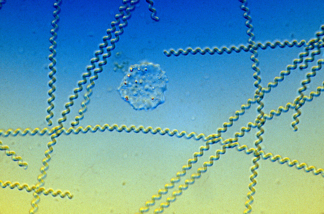 Spirulina major with amoeba,LM