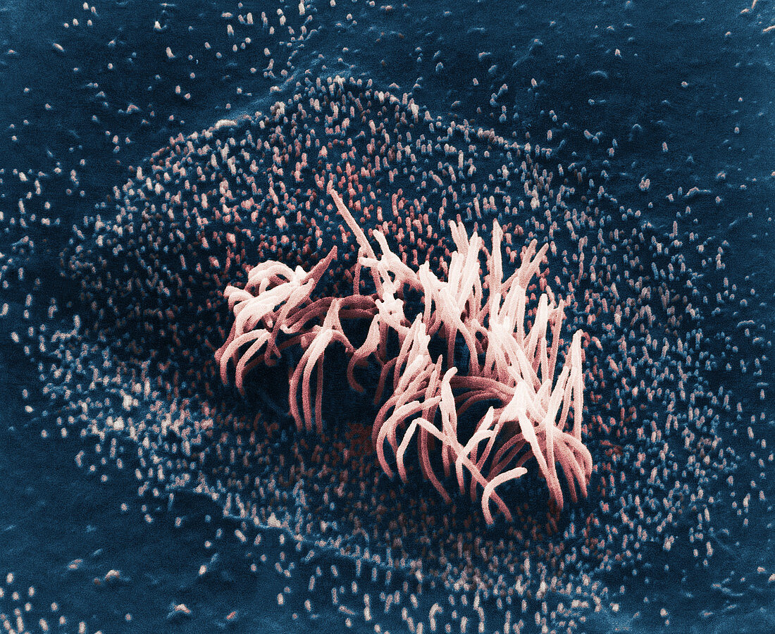 SEM of Cilia on Epithelial Cells