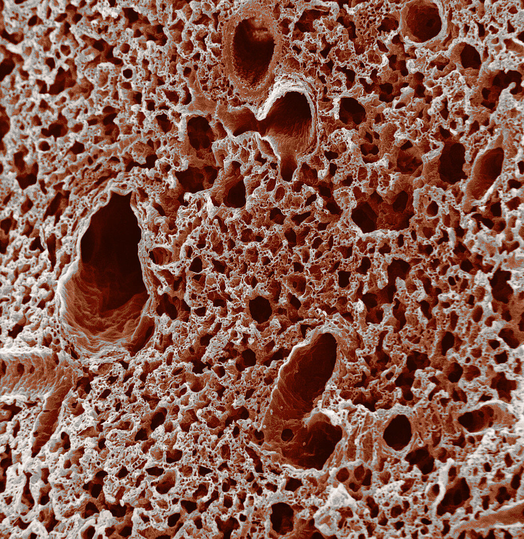 Mouse Lung (SEM)