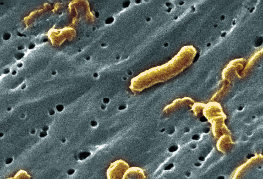 Vibrio cholerae Bacteria,SEM