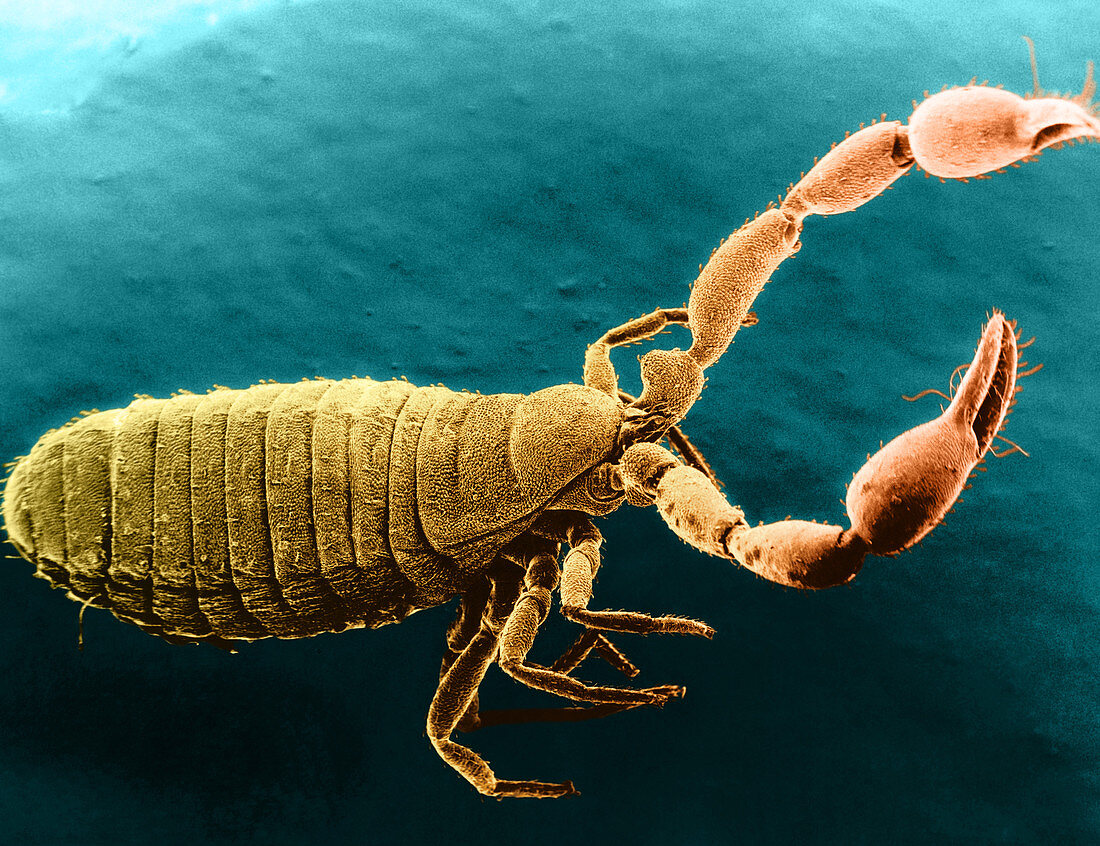 Pseudoscorpion,SEM