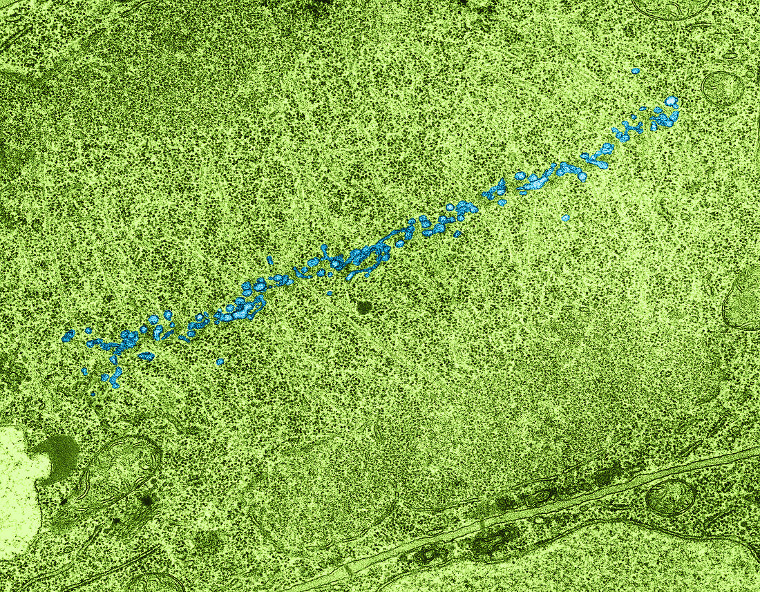 Telophase in Thale Cress (TEM)