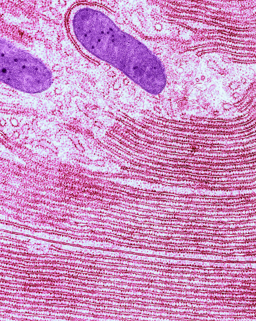 Pancreatic Cell,TEM